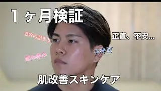 《1ヶ月検証》ニキビ&脂性肌の僕がこのスキンケアを選んだ理由