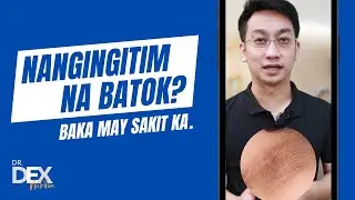 Nangingitim na batok? Baka may sakit ka.