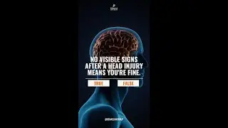 True or False? No visible signs after a head injury means you're fine | Demas Law Group
