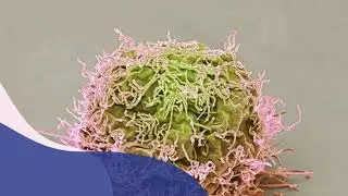 Immunterapi mot akutt lymfatisk leukemi?