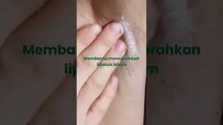 Bantu samarkan lipatan hitam di tubuh ! #ahalotion #glycolicacid10% #AHAskincare #theraskinaha