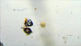 Раковинная амёба (Testacea) -  Микрохламус (Microchlamys).