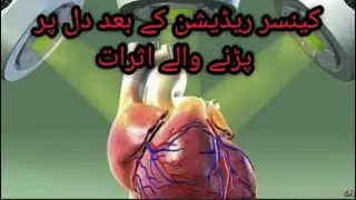How does heart work in Human Body after Radiation of Cancer Patient