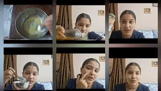 Overnight Dark Spot & Acne Removal | Sarso Oil, Baking Soda & Milk Remedy#homeremedy #skincare#viral