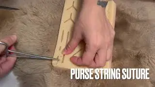 Purse string suture