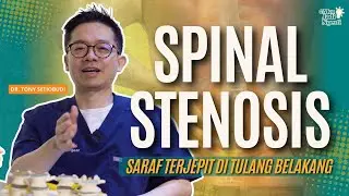 SARAF KEJEPIT DI TULANG BELAKANG, SPINAL STENOSIS | DR TONY SETIOBUDI