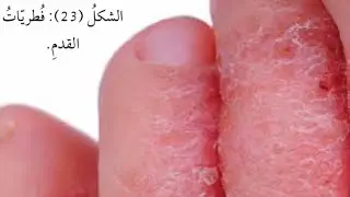 ‏مملكته الفطريات والطلائعيات الجزء الأول - علوم سابع