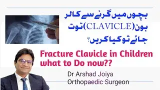 Treatment of collar bone fracture in children| when to do surgery in fx clavicle?| frozen shoulder