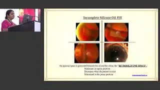 KSOS 2025   GP16   T Dr Meena Chakrabarti  Optimising IOL Power calculations posterior segment patho