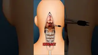Какая у вас СМЕРТЕЛЬНАЯ болезнь? 😲