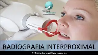 RADIOGRAFIA INTERPROXIMAL