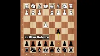 Laurent Fressinet secretly traps his opponent's Queen 🔥🔥 || 2 Minutes Chess