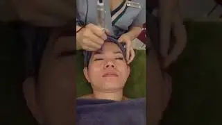 Cấy trẻ h&oacute;a da IDEBENONE - T&aacute;i tạo tế b&agrave;o mới, cho l&agrave;n da trắng s&aacute;ng, trẻ h&oacute;a