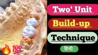 Two' Unit Build up technique| Upper ceramic| dental technician video| anatomy| laboratory| porcelain