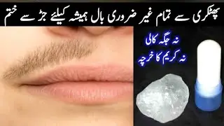 Without threading👉🏻😱I'm surprise how aunty's beard &moustache removed|facial hair removal at home