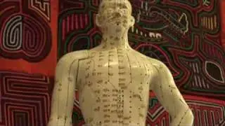 Acupuncture for Depression