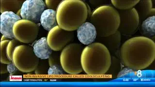 CBS8 - Introducing the CoolSmooth Pro - March 25, 2015 - Pt 2