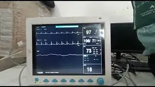Multipara monitor details.