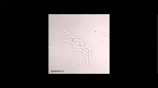 Microcolony growth of S.pombe cells with a cell death event