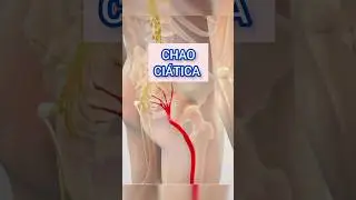 CHAO CI&Aacute;TICA