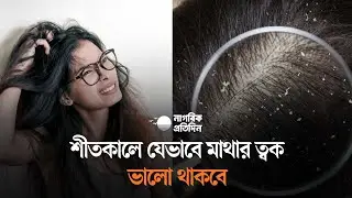 শীতকালে যেভাবে মাথার ত্বক ভালো থাকবে | WinterHairCare | ScalpCare | HairHealth | WinterTips.