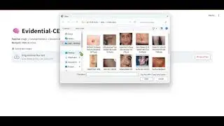 Evidential-CEM &ndash; Skin Disease Classification Demo