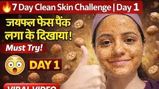 7 Days Clean Skin Challenge (2026) | पिंपल्स, दाग-धब्बे जड़ से खत्म | 100% Natural Remedy 😳