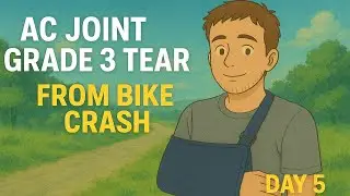AC Joint Grade 3 Tear &ndash; Bike Crash Update (Day 5)