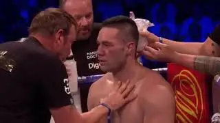 Dillian Whyte vs Joseph Parker Full Fight