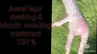 Aseel Legs Swelling And Mouth Swelling Treatment 100%
