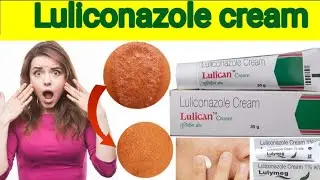 Luliconazole cream:The Antifungal Doctors Recommend most!