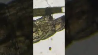 Mosquito larvae under a microscope #smallyoutuber #biology #science #animal #shorts