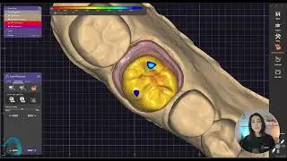 Mastering exocad 01 Fundamentals   Institute of Digital Dentistry 7