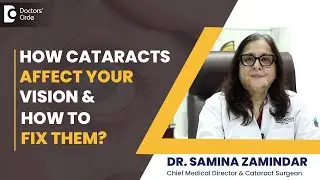 What is a Cataract? Symptoms, Causes & Modern Cataract Surgery - Dr. Samina Zamindar|Doctors' Circle