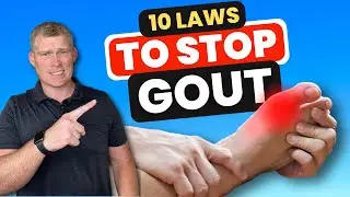 Top 10 Ways to Stop Gout