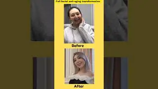 Full facial Anti-aging transformation. #antiaging #facialtransformation #beauty #viralshort
