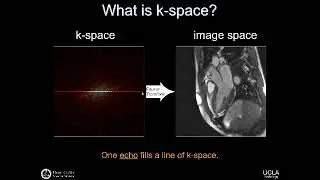2017 Residents' Lectures -  Fast Imaging & Artifacts (Dr. Daniel Ennis)