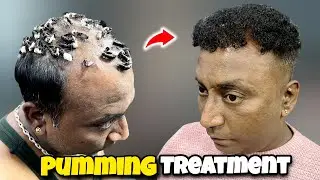 How To Do PumminG Hair Treatment ❌ |🔥 Curly Hair Treatment Men | How To Cover Hair Loss On Top head