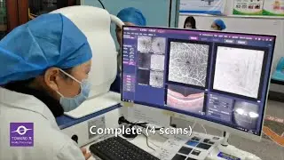 Work flow of TowardPi SS-OCT in daily practice, Model: Yalkaid (100KHz), 4 scans in 2 minutes, Uncut