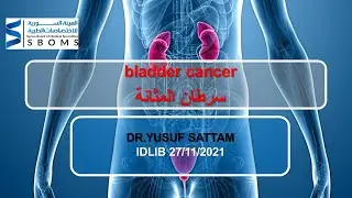 سرطان المثانة -- bladder cancer