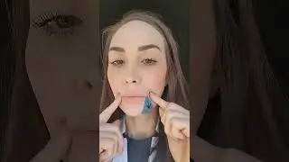 How to Avoid A Crooked Smile After Botox