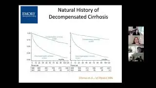 Discussion with Dr. Reshamwala for pre-transplant liver patients