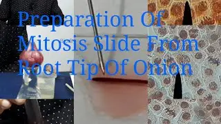 Preparation Of Mitosis Slide From Root Tip Of Onion 