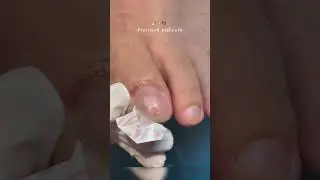 Nail Art !! 💅🏻✨👣 Precision pedicure #nails #nailart #naildesign #beautyhacks #fyp