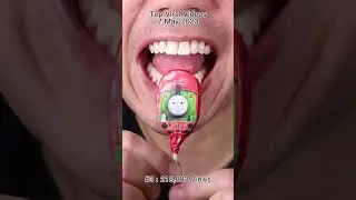 The Most Satisfying Chocolate and Candy ASMR Compilation 🍫🍬 #DoctorTristanPeh #Chocolate #Candy