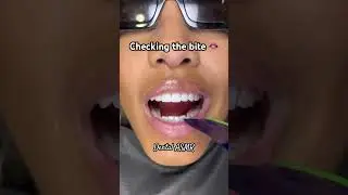Checking the bite 🫦 #asmr #asmrmouthsounds #dentalasmr #veneers #dentalveneers #asmrtingles
