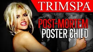 The MLM Exploiting A Celebrity Death For Profit | Multi Level Mondays