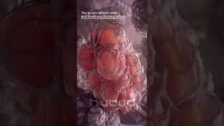 Pneumonia & alveoli up close | medical animation | #pneumonia #pneumoniaanimation #medicalanimation