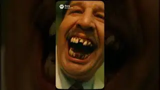 Dentist has the ugliest rotten teeth that I&rsquo;ve ever seen in my entire life. I&rsquo;m now in panic mode.