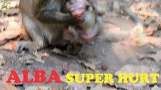 MILLION SAD MOM ANNA BITE HER BABY ALBA SO STRONG HURT TILL SUPER CRY LOUDLY |